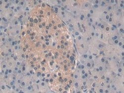 Invitrogen PSMB6 Polyclonal Antibody 200 &mu;L; Unconjugated:Antibodies,