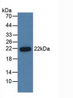 Invitrogen PSMB6 Polyclonal Antibody 20 &mu;L; Unconjugated:Antibodies,