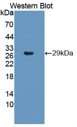 Invitrogen PSMB6 Polyclonal Antibody 200 &mu;L; Unconjugated:Antibodies,
