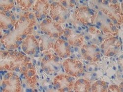 Invitrogen PSMB9 Polyclonal Antibody:Antibodies:Primary Antibodies