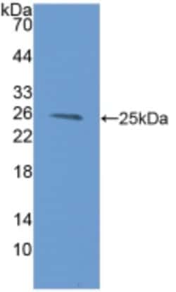 Invitrogen PSMB9 Polyclonal Antibody:Antibodies:Primary Antibodies