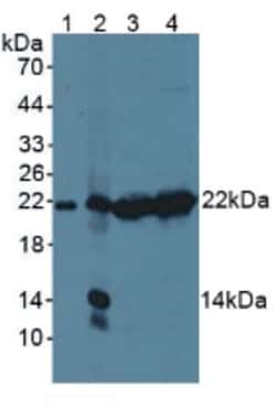 Invitrogen PSMB9 Polyclonal Antibody:Antibodies:Primary Antibodies