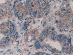 Invitrogen ERp72 Polyclonal Antibody:Antibodies:Primary Antibodies