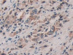Invitrogen ERp72 Polyclonal Antibody:Antibodies:Primary Antibodies