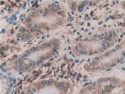 Invitrogen ERp72 Polyclonal Antibody:Antibodies:Primary Antibodies