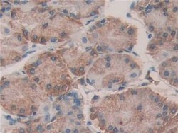 Invitrogen ERp72 Polyclonal Antibody:Antibodies:Primary Antibodies
