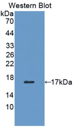 Invitrogen ERp72 Polyclonal Antibody:Antibodies:Primary Antibodies