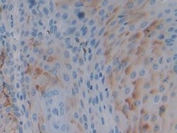 Invitrogen&trade;&nbsp;PTPRH Polyclonal Antibody