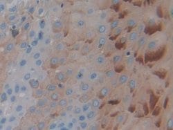 Invitrogen™ PTPRH Polyclonal Antibody