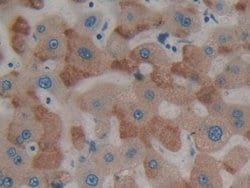 Invitrogen&trade;&nbsp;PTPRH Polyclonal Antibody