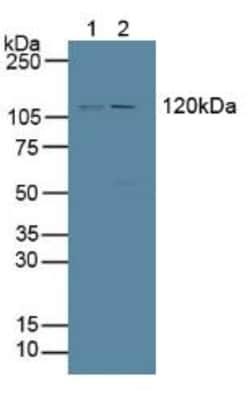 Invitrogen PTPRH Polyclonal Antibody 200 &mu;L; Unconjugated:Antibodies,