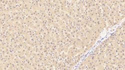 Invitrogen™ PTPRH Polyclonal Antibody