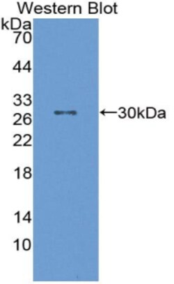 Invitrogen PTPRH Polyclonal Antibody 200 &mu;L; Unconjugated:Antibodies,