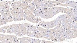 Invitrogen PRL3 Polyclonal Antibody 20 &mu;L; Unconjugated:Antibodies,