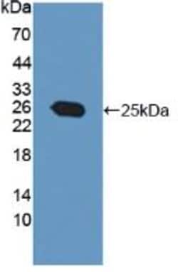 Invitrogen PRL3 Polyclonal Antibody 20 &mu;L; Unconjugated:Antibodies,