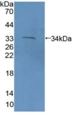 Invitrogen PCDH15 Polyclonal Antibody:Antibodies:Primary Antibodies