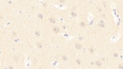 Invitrogen PCDHB15 Polyclonal Antibody 200 &mu;L | Buy Online | Invitrogen&trade; | Fisher Scientific