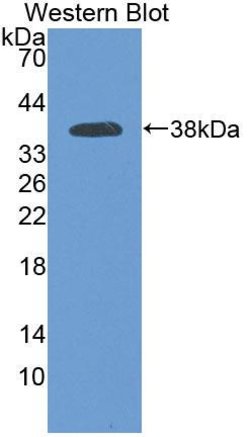 Invitrogen PCDHB15 Polyclonal Antibody 200 &mu;L | Buy Online | Invitrogen&trade; | Fisher Scientific