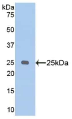 Invitrogen NPEPPS Polyclonal Antibody 20 &mu;L; Unconjugated:Antibodies,