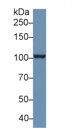 Invitrogen NPEPPS Polyclonal Antibody 200 &mu;L | Buy Online | Invitrogen&trade; | Fisher Scientific
