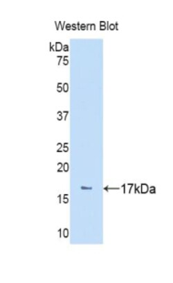 Invitrogen NPEPPS Polyclonal Antibody 200 &mu;L | Buy Online | Invitrogen&trade; | Fisher Scientific