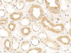 Invitrogen NPEPPS Polyclonal Antibody 200 &mu;L | Buy Online | Invitrogen&trade; | Fisher Scientific