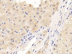 Invitrogen NPEPPS Polyclonal Antibody 200 &mu;L | Buy Online | Invitrogen&trade; | Fisher Scientific