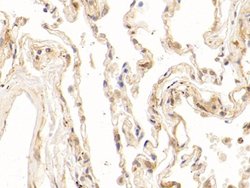 Invitrogen NPEPPS Polyclonal Antibody 200 &mu;L | Buy Online | Invitrogen&trade; | Fisher Scientific