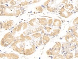 Invitrogen NPEPPS Polyclonal Antibody 200 &mu;L | Buy Online | Invitrogen&trade; | Fisher Scientific