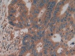 Invitrogen PKM2 Polyclonal Antibody:Antibodies:Primary Antibodies