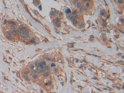Invitrogen PKM2 Polyclonal Antibody 200 &mu;L; Unconjugated:Antibodies,