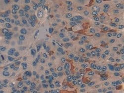 Invitrogen PKM2 Polyclonal Antibody:Antibodies:Primary Antibodies