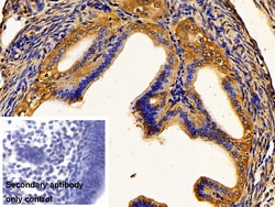 Invitrogen PKM2 Polyclonal Antibody 200 &mu;L; Unconjugated:Antibodies,