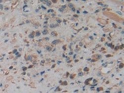 Invitrogen PKM2 Polyclonal Antibody:Antibodies:Primary Antibodies