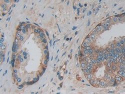 Invitrogen PKM2 Polyclonal Antibody:Antibodies:Primary Antibodies