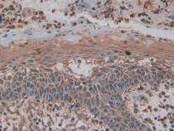 Invitrogen PKM2 Polyclonal Antibody:Antibodies:Primary Antibodies