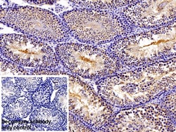 Invitrogen PKM2 Polyclonal Antibody 200 &mu;L; Unconjugated:Antibodies,