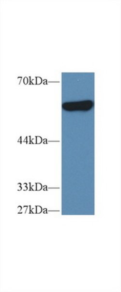 Invitrogen PKM2 Polyclonal Antibody:Antibodies:Primary Antibodies
