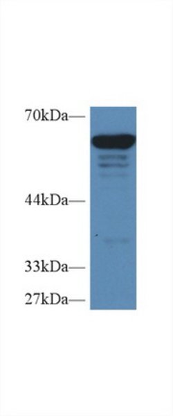 Invitrogen PKM2 Polyclonal Antibody:Antibodies:Primary Antibodies