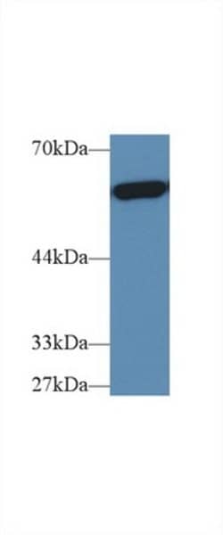 Invitrogen PKM2 Polyclonal Antibody:Antibodies:Primary Antibodies