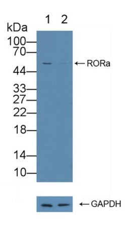 Invitrogen RORA Polyclonal Antibody:Antibodies:Primary Antibodies