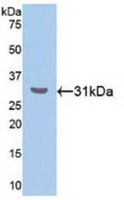Invitrogen RORA Polyclonal Antibody:Antibodies:Primary Antibodies