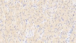 Invitrogen RANK (CD265) Polyclonal Antibody:Antibodies:Primary Antibodies