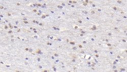 Invitrogen RANK (CD265) Polyclonal Antibody:Antibodies:Primary Antibodies