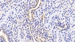 Invitrogen RANK (CD265) Polyclonal Antibody:Antibodies:Primary Antibodies