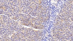 Invitrogen RANK (CD265) Polyclonal Antibody:Antibodies:Primary Antibodies