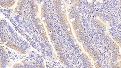 Invitrogen RANK (CD265) Polyclonal Antibody:Antibodies:Primary Antibodies