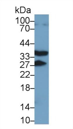 Invitrogen RANK (CD265) Polyclonal Antibody:Antibodies:Primary Antibodies