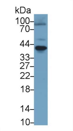 Invitrogen RANK (CD265) Polyclonal Antibody 20 &mu;L; Unconjugated:Antibodies,