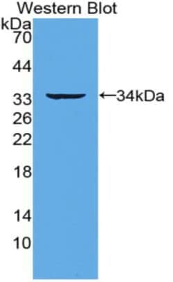 Invitrogen RANK (CD265) Polyclonal Antibody:Antibodies:Primary Antibodies